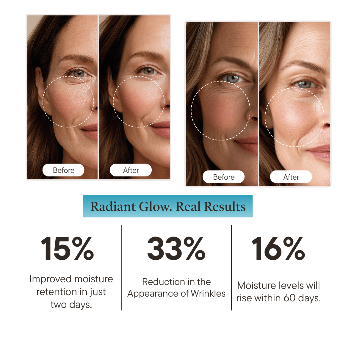 4D Hyaluronic Acid Serum Before and after effects of a skincare product on a woman's face with statistical improvements.
