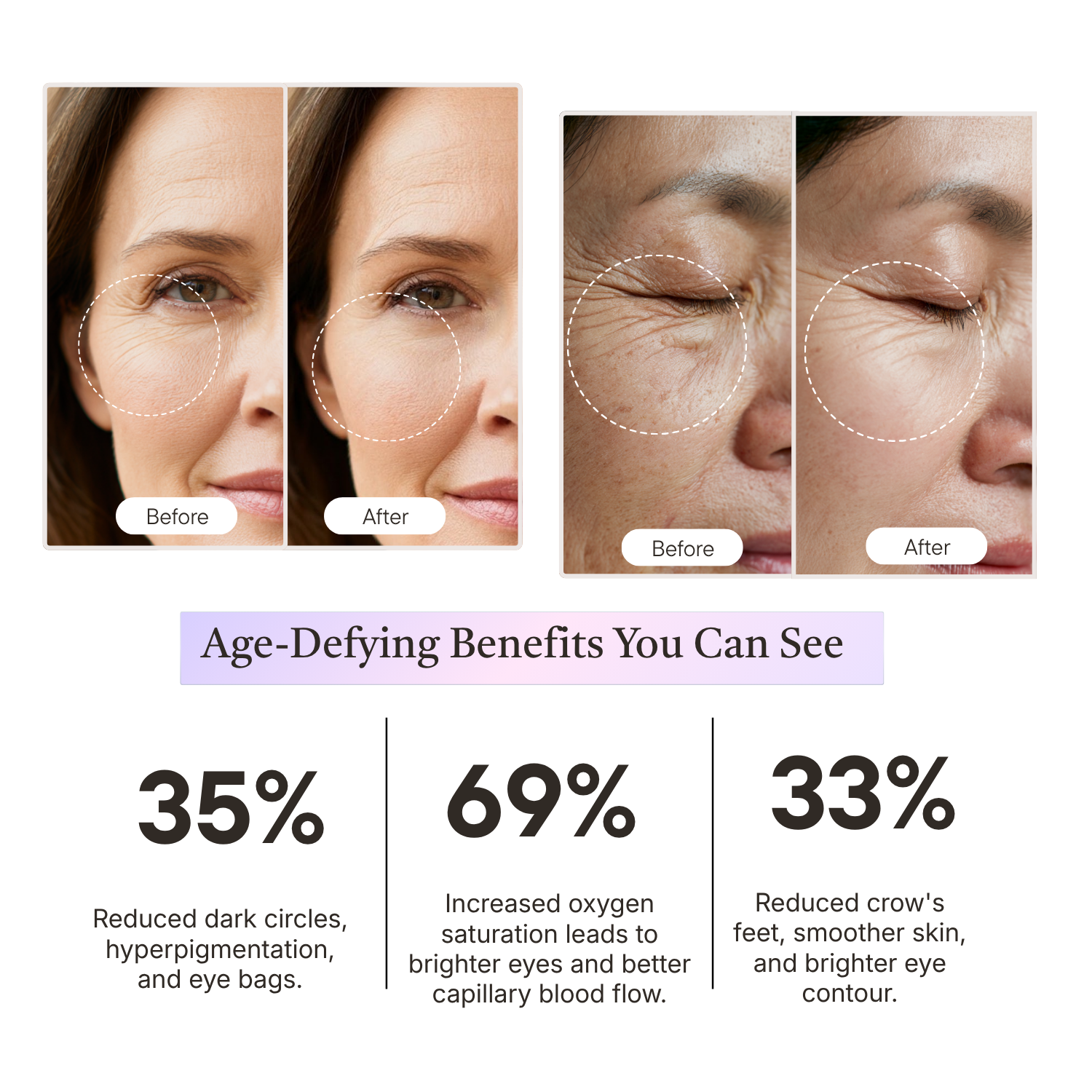 Before and after effects of a skincare treatment on a woman's face, with statistics on age-defying benefits.