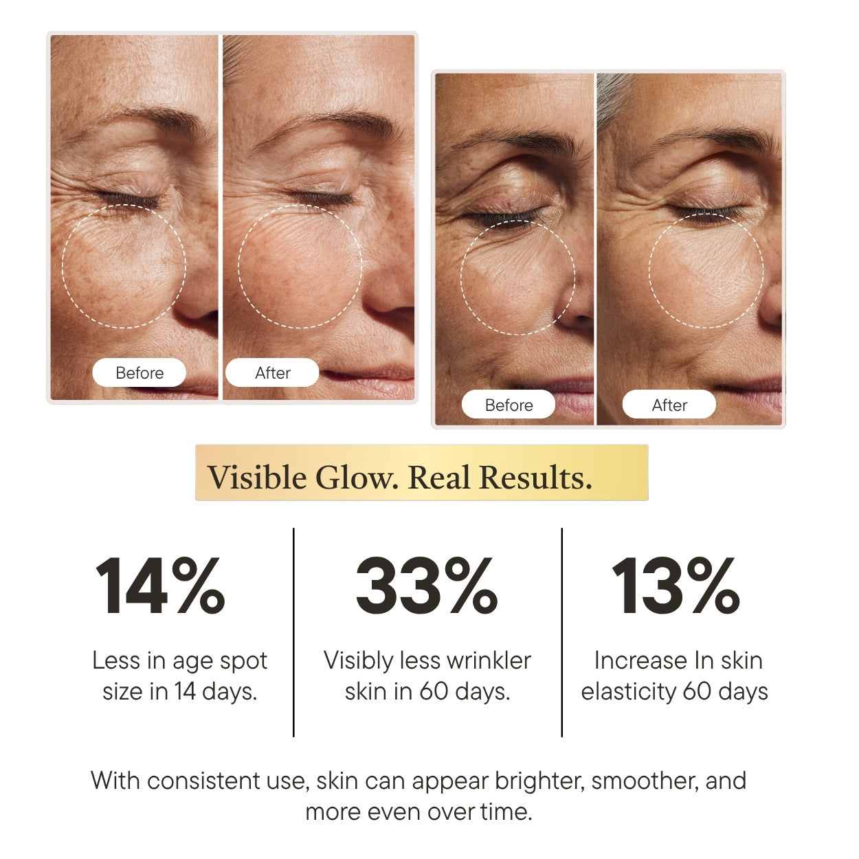 Skinact Vitamin C Brightening Serum  | Before and after effects of a skincare product on skin, with visible improvements in age spots, wrinkles, and elasticity.